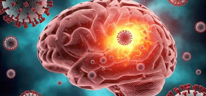 Brain Infection
